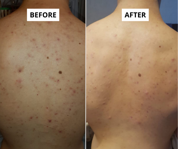skin 5