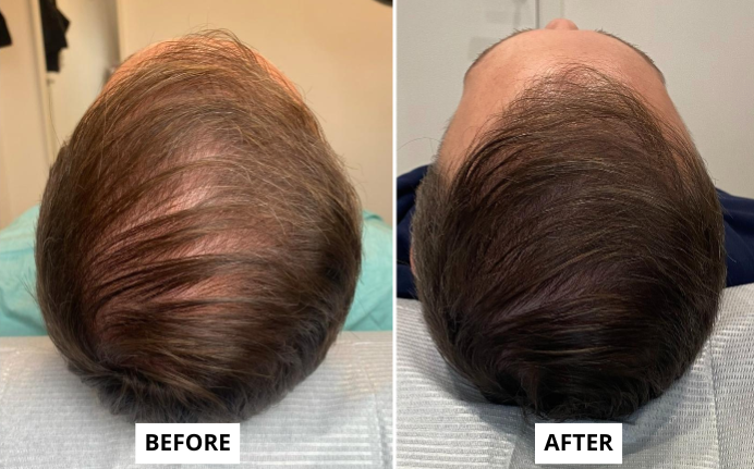hair 1