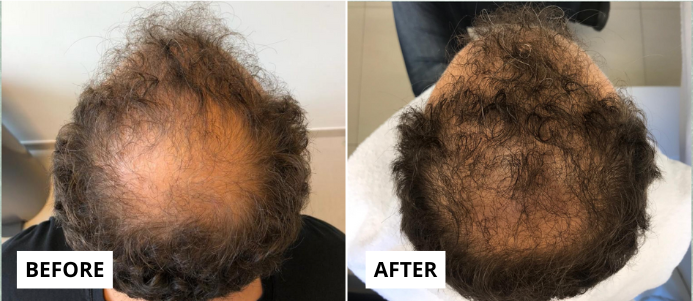 hair 3