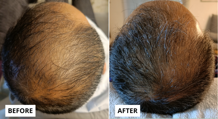 hair 4