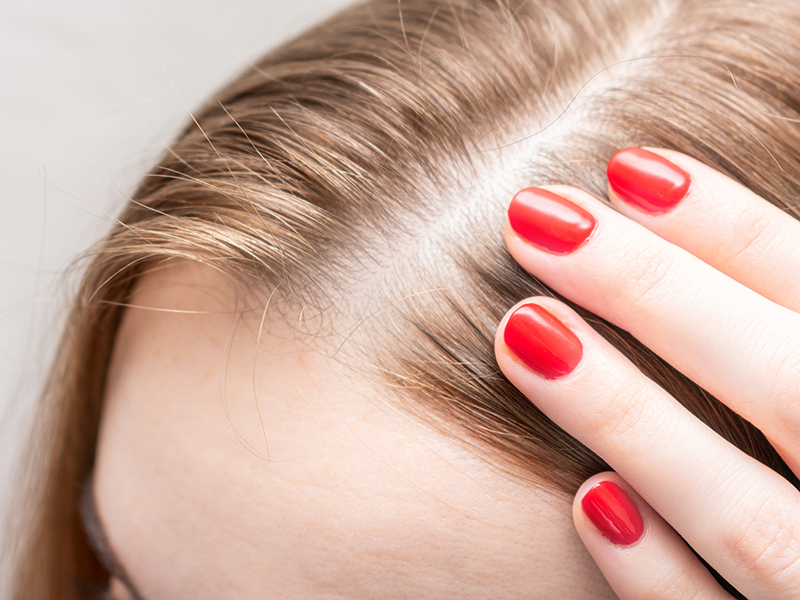 Hair Loss - Natural Rejuvenation of Skin & Hair - REYU